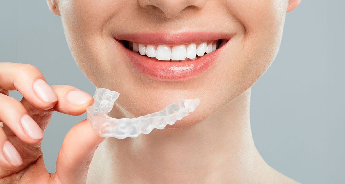 An Aesthetic Revolution in Orthodontic Treatment: Clear Alignment Treatment