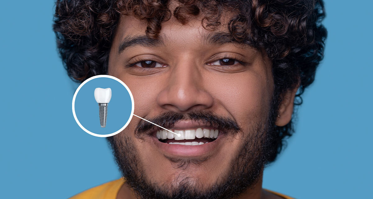 Fast and Permanent Solution to Your Lost Teeth with Implants in One Day | Ova Dental Clinic, Kartal